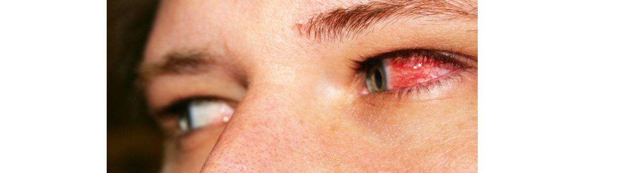 signs-you-have-an-eye-disorder