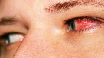 signs-you-have-an-eye-disorder